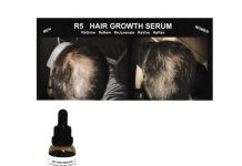 R5生髮液 還你濃密毛髮 倍增自信